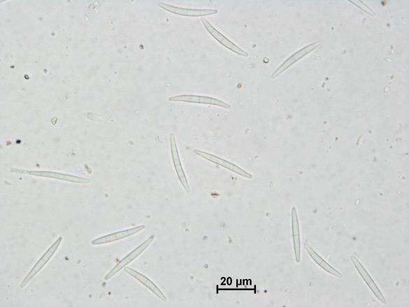 Gremmeniella abietina