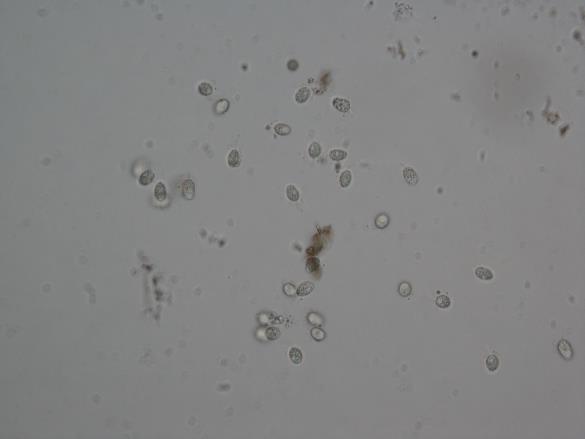 Guignardia philoprina