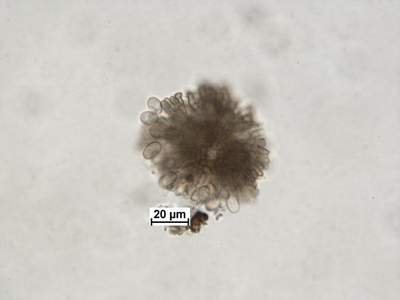 Tubakia dryina