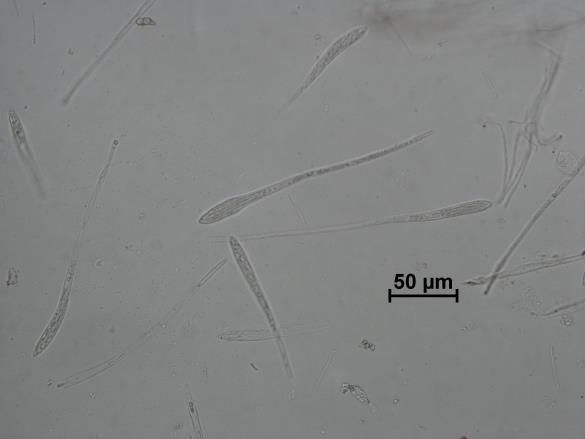 Colpoma quercinum
