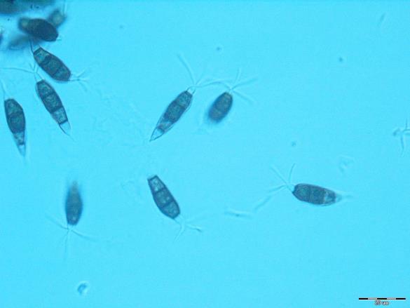 Pestalotia funerea