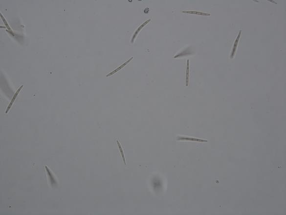 Phloeospora aceris
