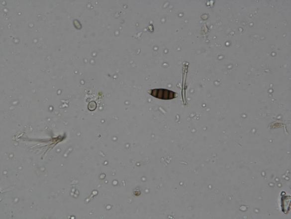 Seiridium cardinale