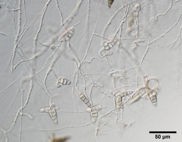 <i>Asterosporium asterospermum</i>