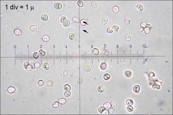 Phellinus conchatus