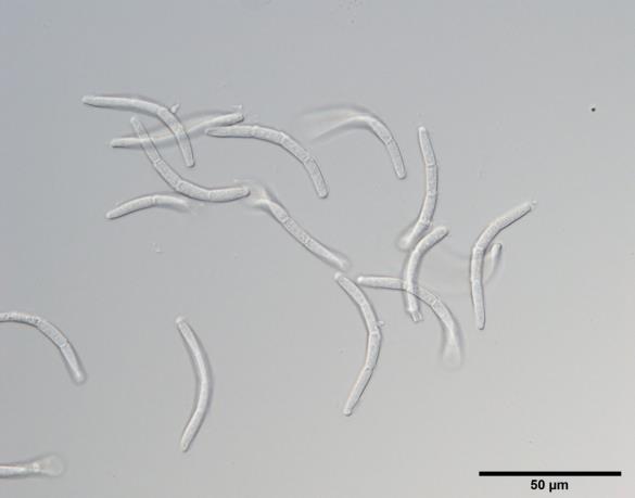 <i>Sphaerulina quercicola</i>