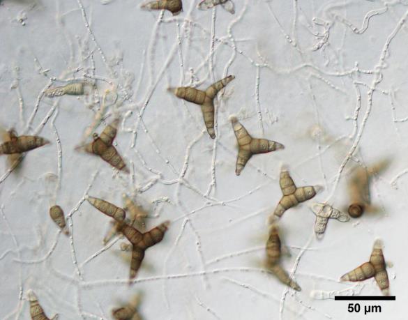 <i>Asterosporium asterospermum</i>