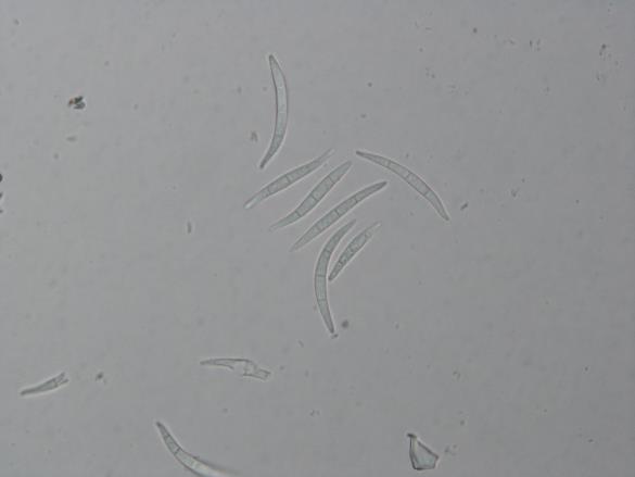 Gremmeniella abietina