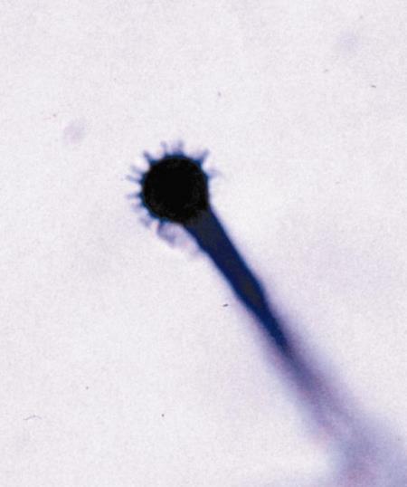 Heterobasidion spp.
