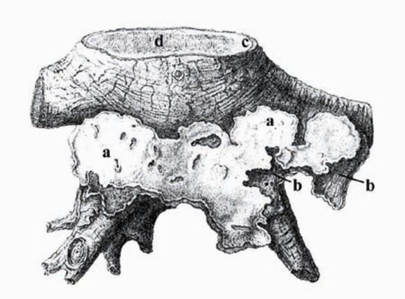 Heterobasidion annosum