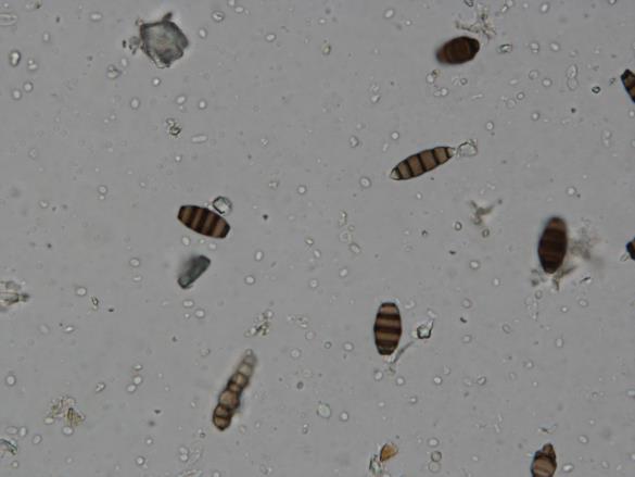 Seiridium cardinale