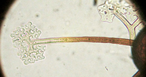 <i>Podosphaera myrtillina</i>