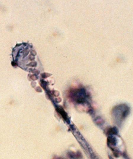 Heterobasidion spp.