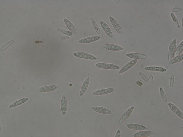 Botryosphaeria dothidea