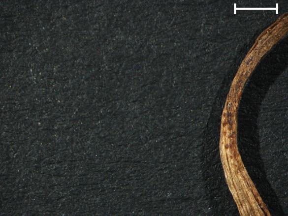 Aecidium ficariae