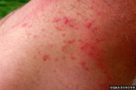 Euproctis chrysorrhoea