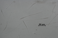 Colpoma quercinum