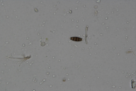 Seiridium cardinale