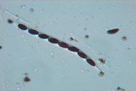 Biscogniauxia mediterranea