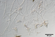 Asterosporium asterospermum