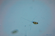 Truncatella hartigii