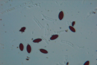 Biscogniauxia mediterranea