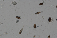 Seiridium cardinale