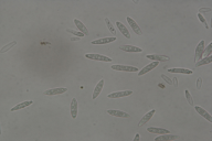 Botryosphaeria dothidea