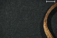 Aecidium ficariae